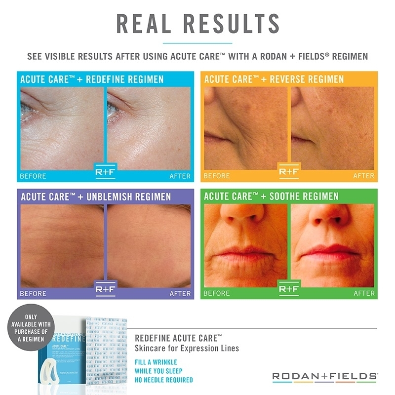 Before and After ACUTE CARE