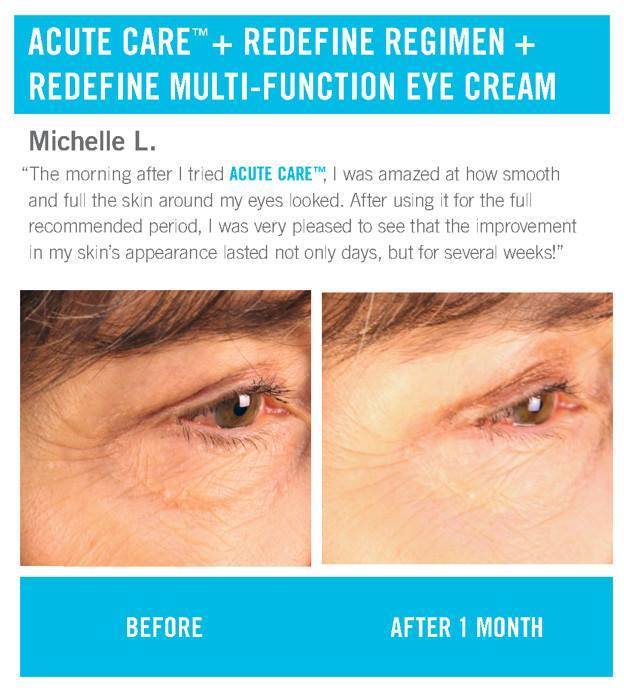 rodan and fields wrinkle cream