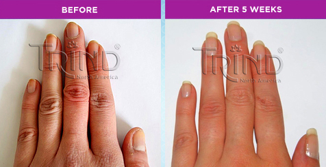 trind nail revive natural