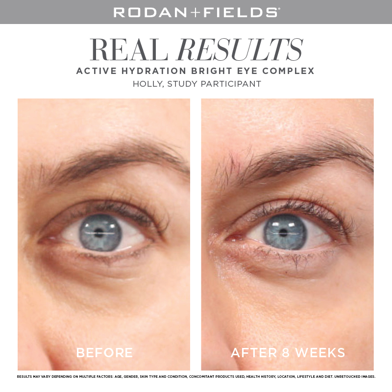 rodan fields eye serum