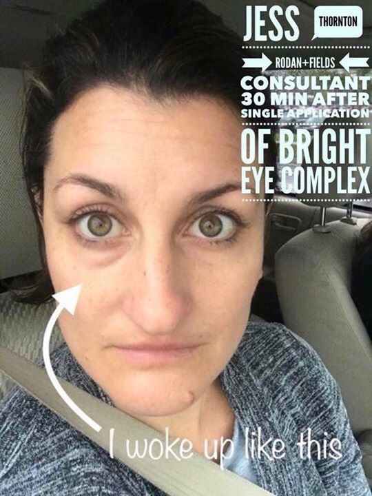 bright eye complex before and after