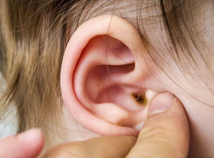 Sleep Tight with Homeopathy REMINDER FREE Phone Support Anxiety and Panic Attacks