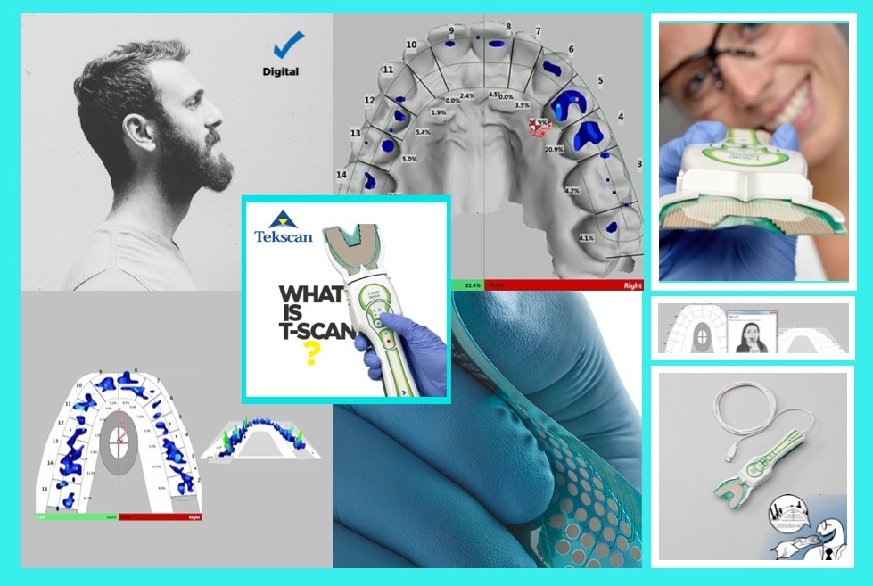 Digita DENTISTRY How accurate is the diagnosis with "Articulating