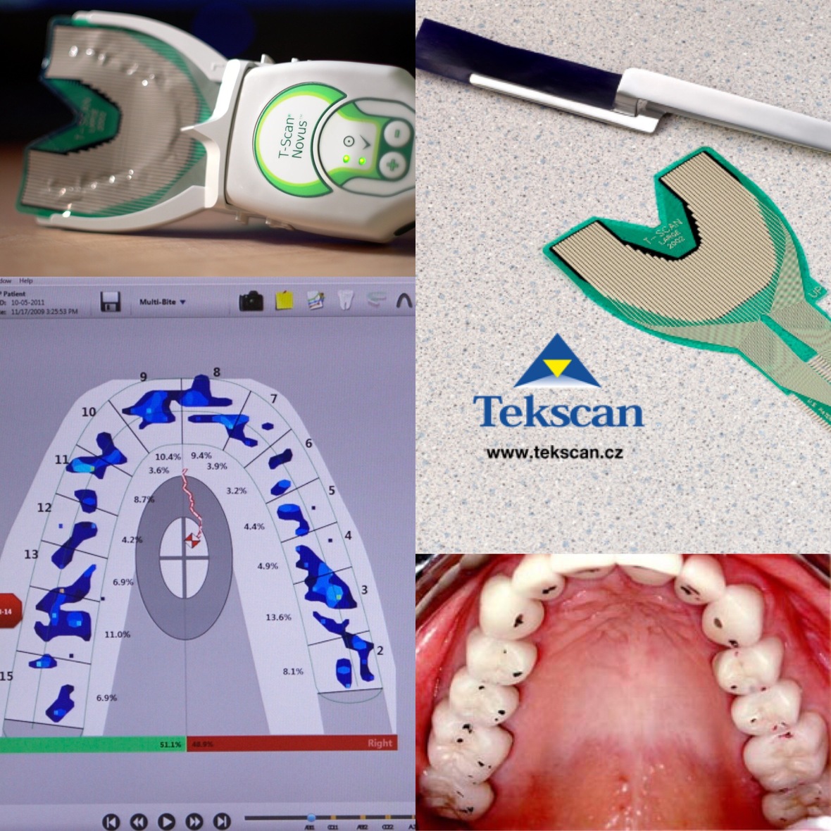 Digita DENTISTRY How accurate is the diagnosis with "Articulating